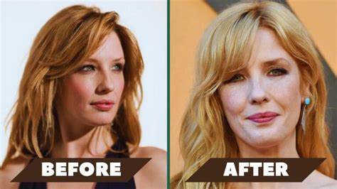 kelly reilly surgery|Kelly Reilly’s Lip Surgery: Separating Fact From Fiction With Photos!